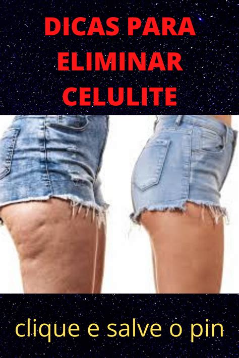 bundas com celulite|8 Dicas Para Eliminar Celulite